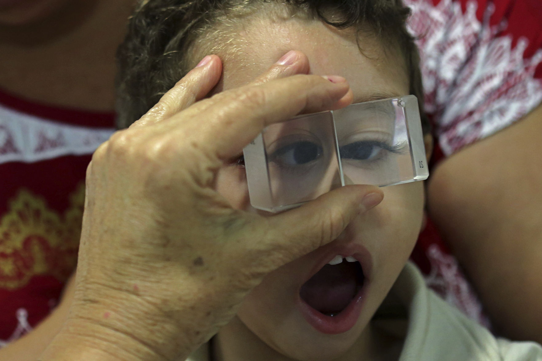 Brazil Zika Kids